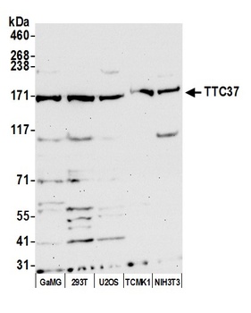 TTC37 Antibody