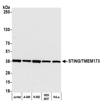 STING/TMEM173 Antibody