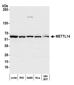 METTL14 Antibody