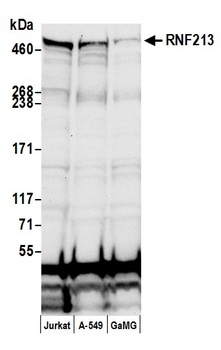 RNF213 Antibody