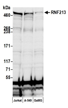 Rabbit anti-RNF213 Antibody