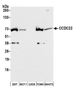 Rabbit anti-CCDC22 Antibody