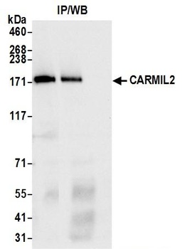 Rabbit anti-CARMIL2 Antibody