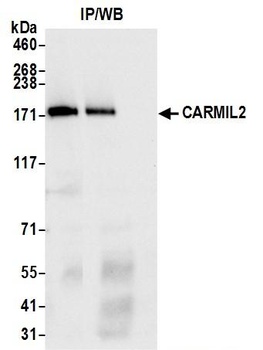 CARMIL2 Antibody