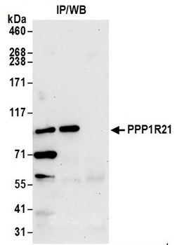 Rabbit anti-PPP1R21 Antibody