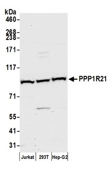 PPP1R21 Antibody