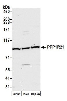 Rabbit anti-PPP1R21 Antibody