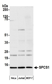 Rabbit anti-SPCS1 Antibody