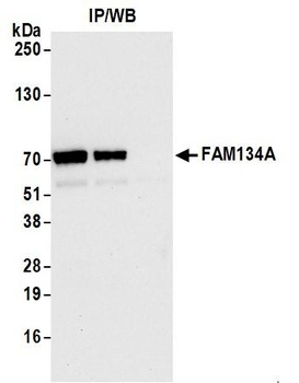 FAM134A Antibody