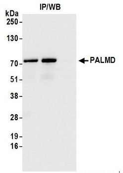 PALMD Antibody