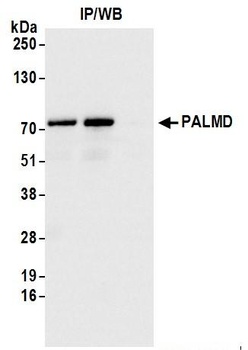 Rabbit anti-PALMD Antibody