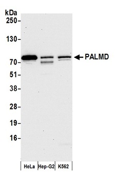 Rabbit anti-PALMD Antibody