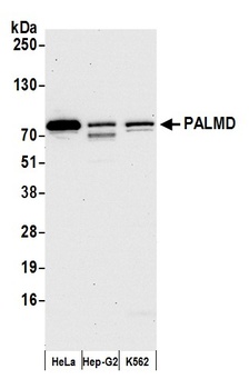 PALMD Antibody