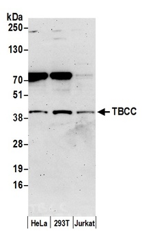 Rabbit anti-TBCC Antibody