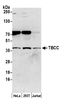 TBCC Antibody