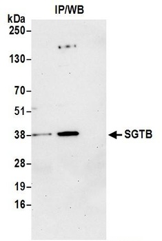 SGTB Antibody