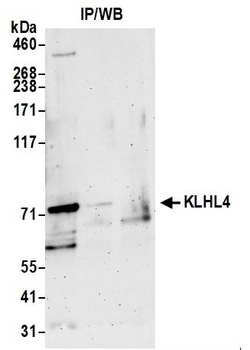 KLHL4 Antibody