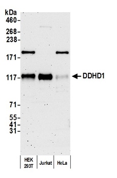 DDHD1 Antibody