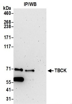 TBCK Antibody