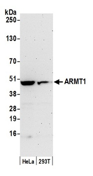 ARMT1 Antibody