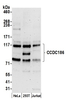 Rabbit anti-CCDC186 Antibody