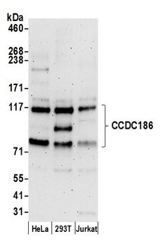 CCDC186 Antibody