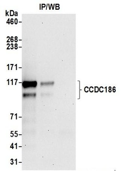 CCDC186 Antibody