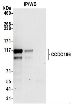 Rabbit anti-CCDC186 Antibody