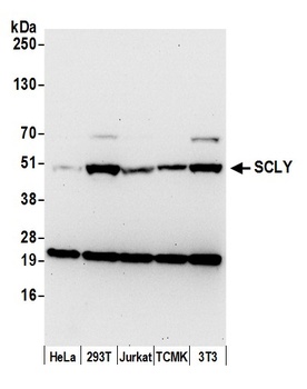 SCLY Antibody