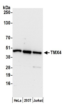 TMX4 Antibody