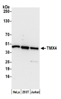 Rabbit anti-TMX4 Antibody