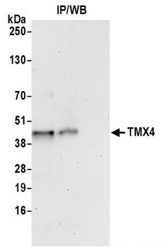 Rabbit anti-TMX4 Antibody