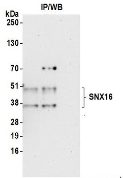 Rabbit anti-SNX16 Antibody