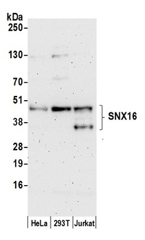 Rabbit anti-SNX16 Antibody