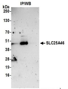 SLC25A46 Antibody