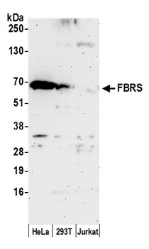 FBRS Antibody