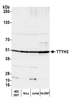 TTYH3 Antibody