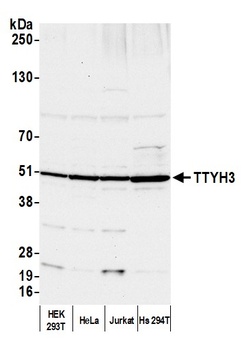 Rabbit anti-TTYH3 Antibody