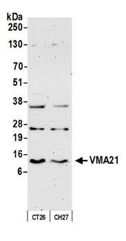 Rabbit anti-VMA21 Antibody