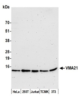 Rabbit anti-VMA21 Antibody