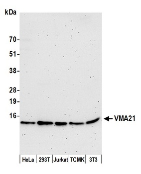 VMA21 Antibody