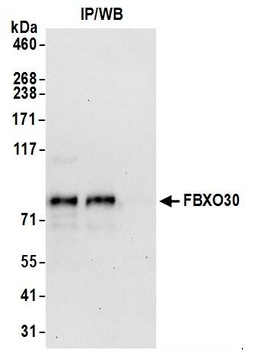 FBXO30 Antibody