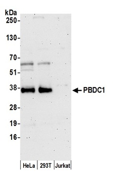 Rabbit anti-PBDC1 Antibody