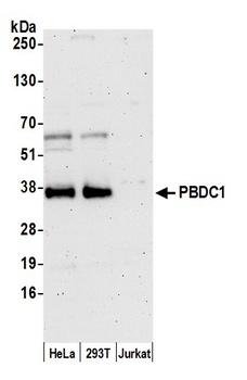 PBDC1 Antibody