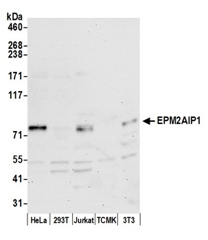 EPM2AIP1 Antibody