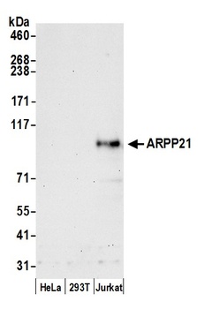 Rabbit anti-ARPP21 Antibody