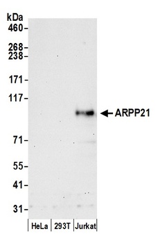 ARPP21 Antibody