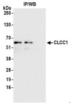 CLCC1 Antibody