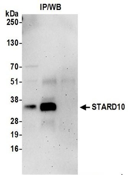 STARD10 Antibody