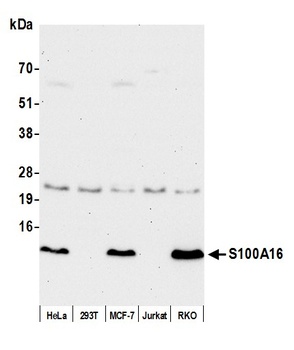 S100A16 Antibody